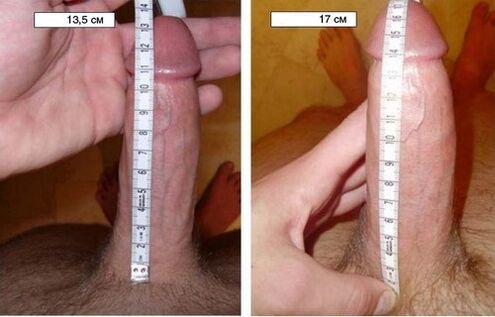 penis before and after enlargement with a pump