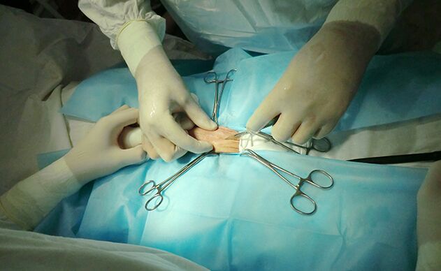 Surgery on the reproductive organs will help increase their size